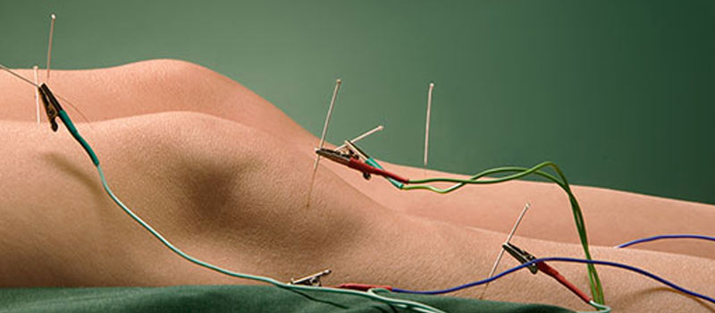 Cancer Patient Trial Finds Acupuncture Improves Symptoms of Chemotherapy Neuropathy
